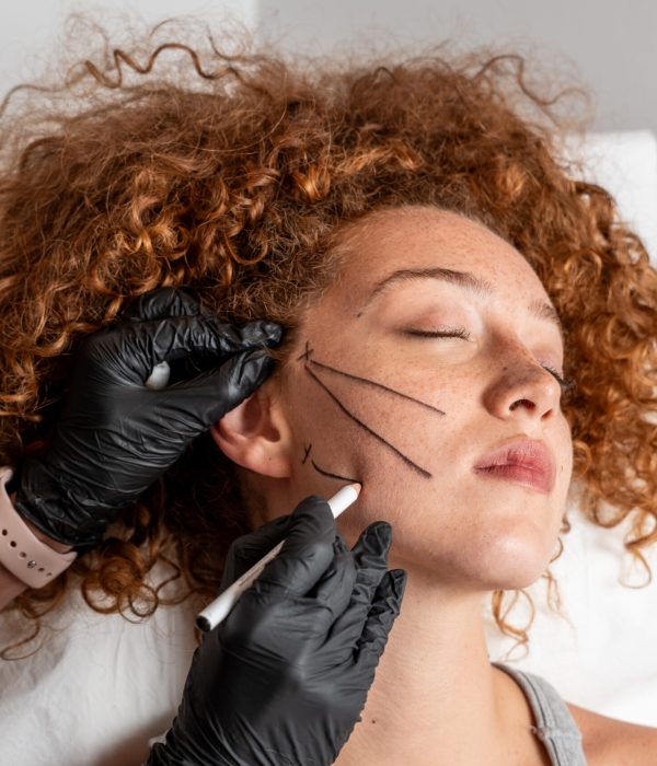 Fili di Trazione Bari