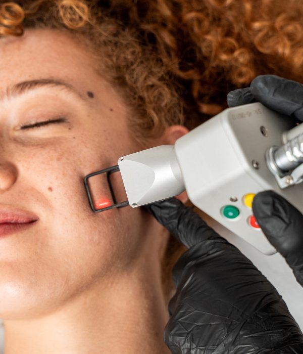 Laser Frazionato Resurfacing CO2 Bari